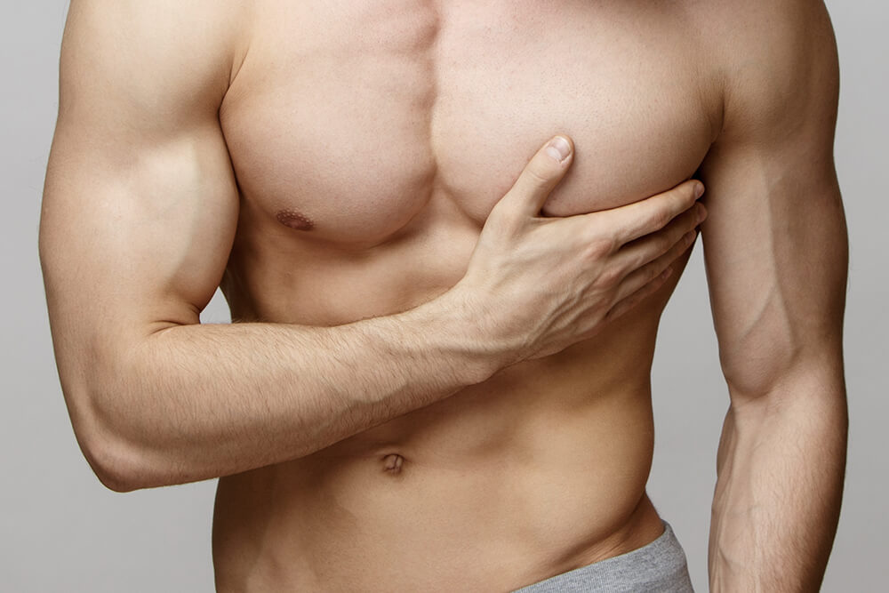 Gynecomastia