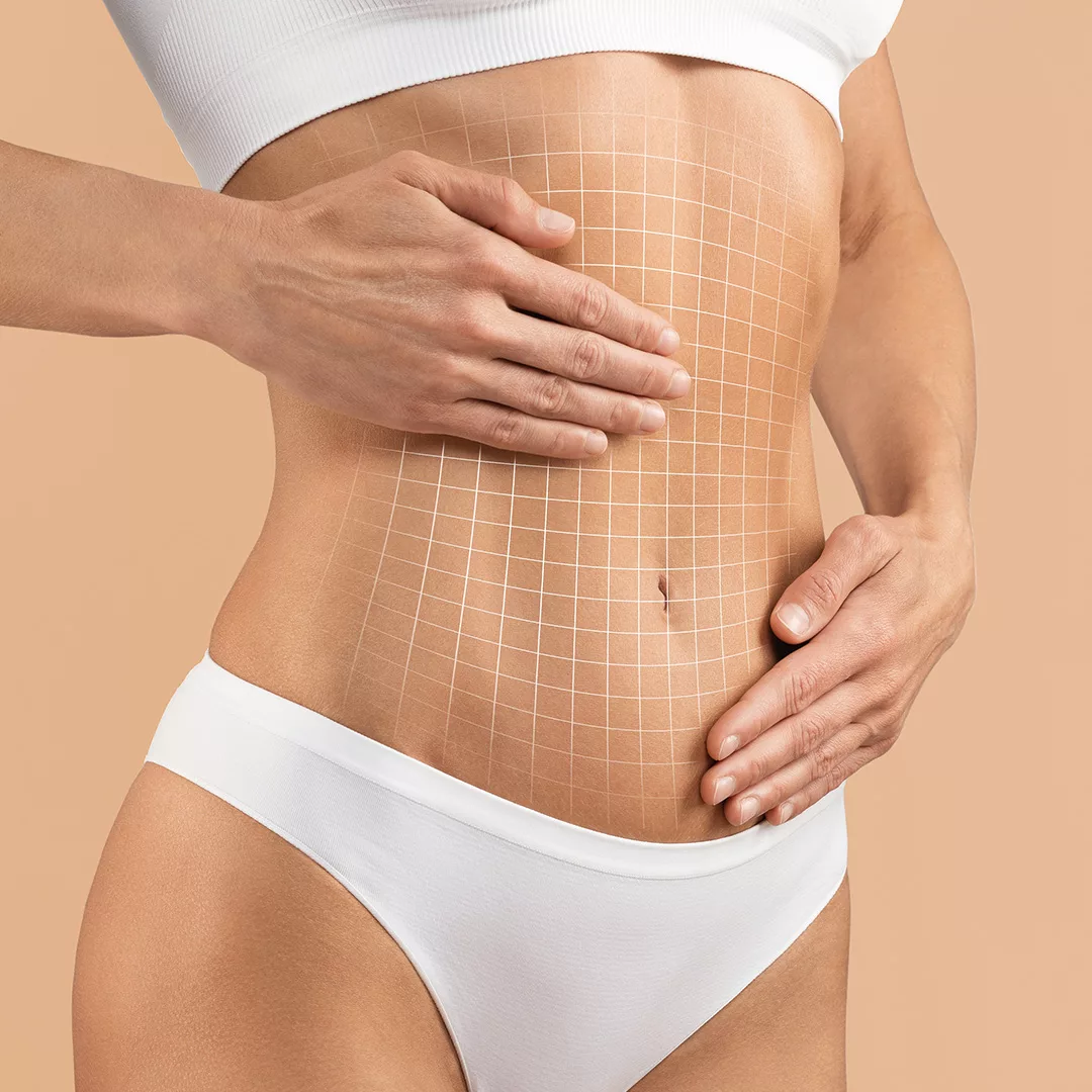 Tummy Tuck